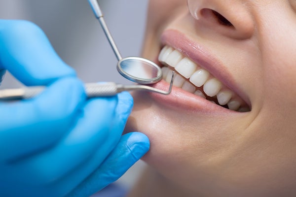 Perché è importante l’igiene dentale professionale
