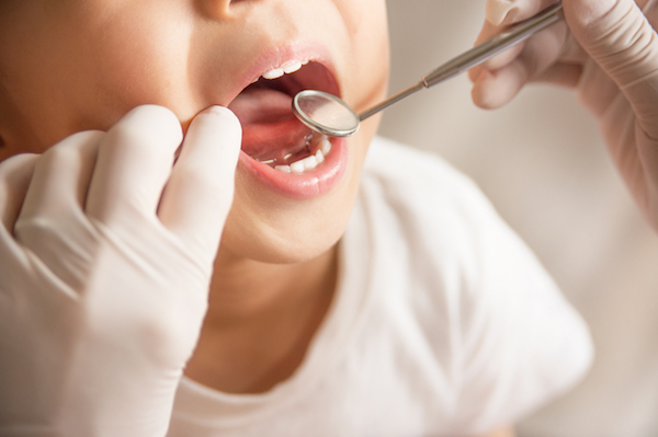 Mal di denti nei bambini: cause, prevenzione e cura