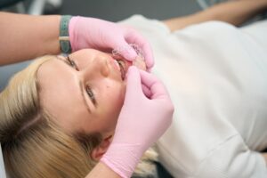donna distesa sulla poltrona del dentista prova una mascherina trasparente per allineare i denti storti