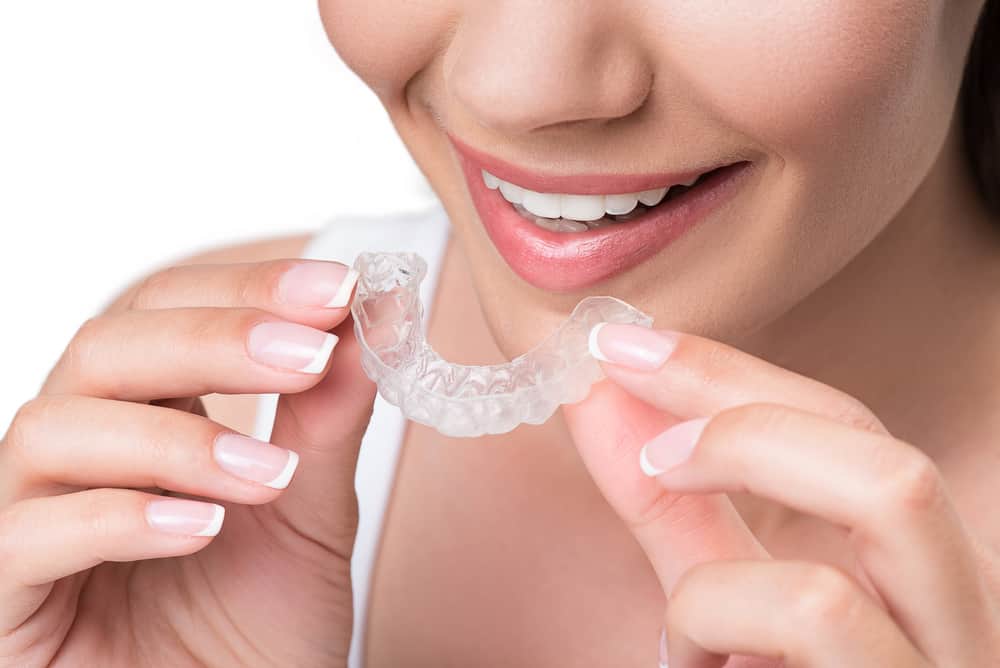 dettaglio della bocca di una ragazza che sorride mentre indossa un bite dentale per proteggere i denti dal bruxismo e dai problemi di malocclusione