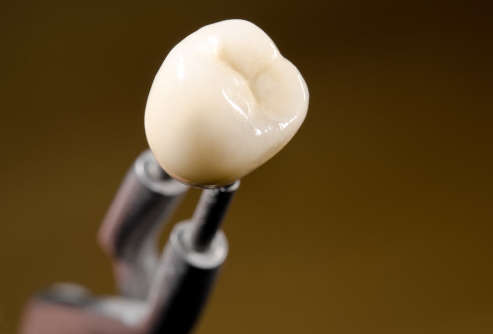 corona dentale in ceramica, dettaglio su pinzette da odontotecnico