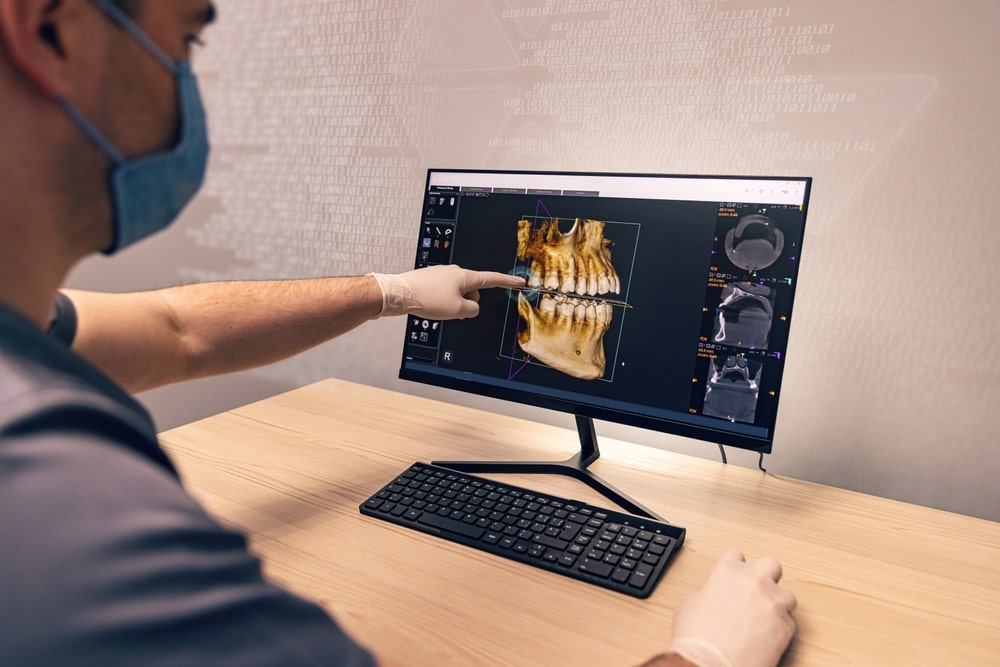 dentista indica l'osso mascellare ritirato al computer