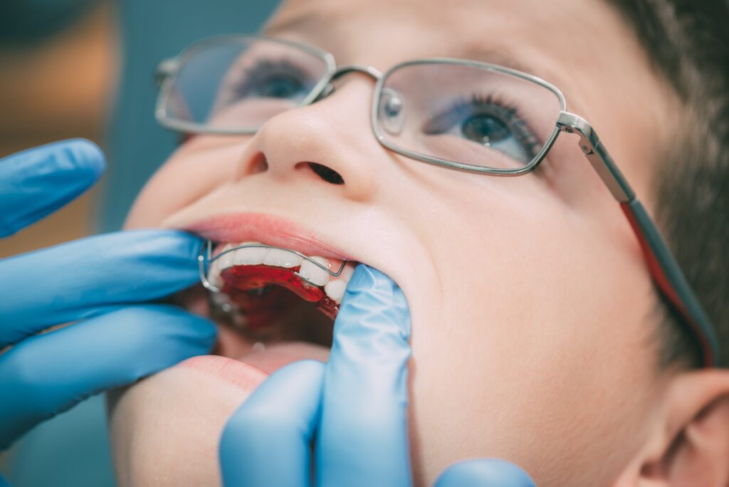 dettaglio bocca bambino con apparecchio denti