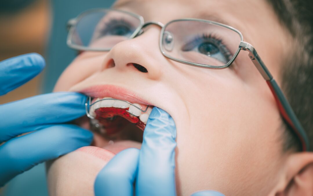 Quali sono le terapie ortodontiche per bambini
