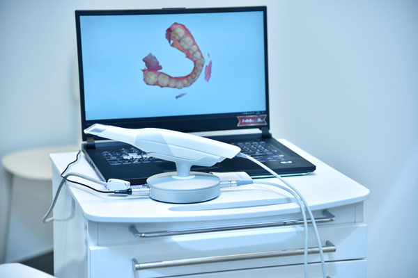 Scanner Intraorale 3D